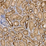 Immunohistochemistry - Anti-Dishevelled 3 Antibody (A11691) - Antibodies.com