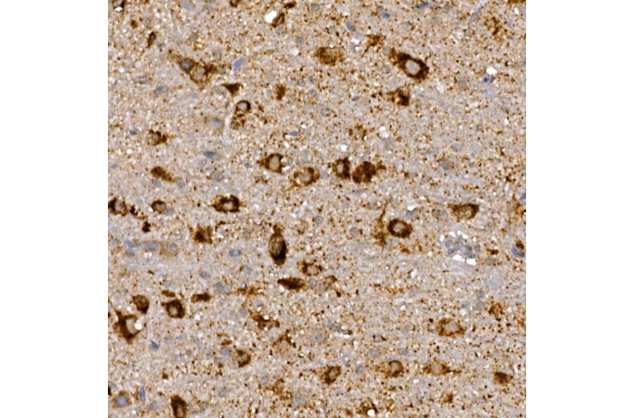 Immunohistochemistry - Anti-Dishevelled 3 Antibody (A11691) - Antibodies.com