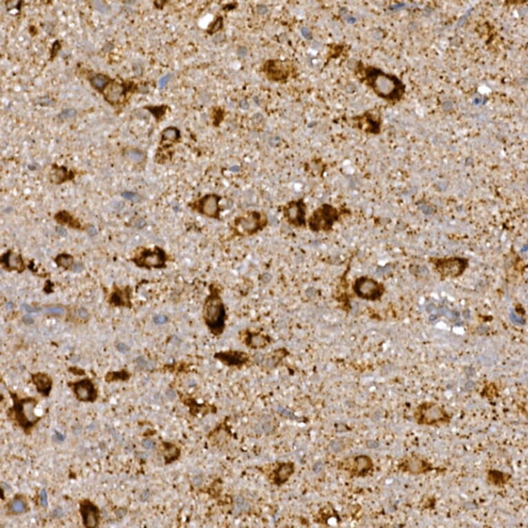 Immunohistochemistry - Anti-Dishevelled 3 Antibody (A11691) - Antibodies.com