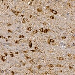 Immunohistochemistry - Anti-Dishevelled 3 Antibody (A11691) - Antibodies.com