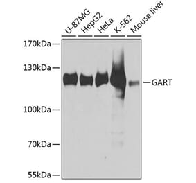 Western Blot - Anti-GART Antibody (A11693) - Antibodies.com