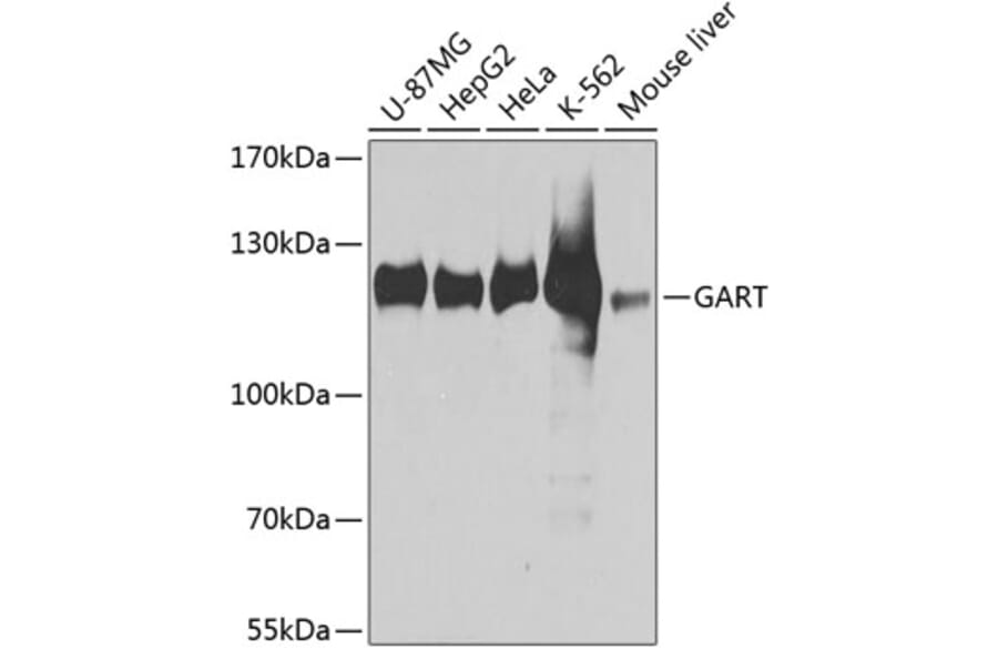 Western Blot - Anti-GART Antibody (A11693) - Antibodies.com