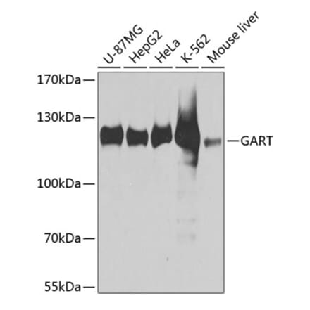 Western Blot - Anti-GART Antibody (A11693) - Antibodies.com