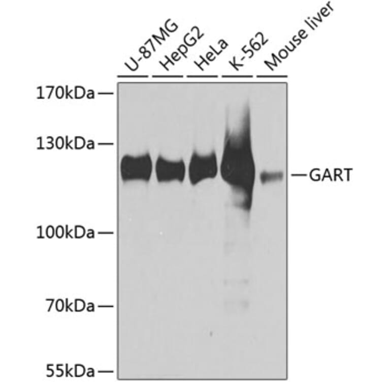 Western Blot - Anti-GART Antibody (A11693) - Antibodies.com