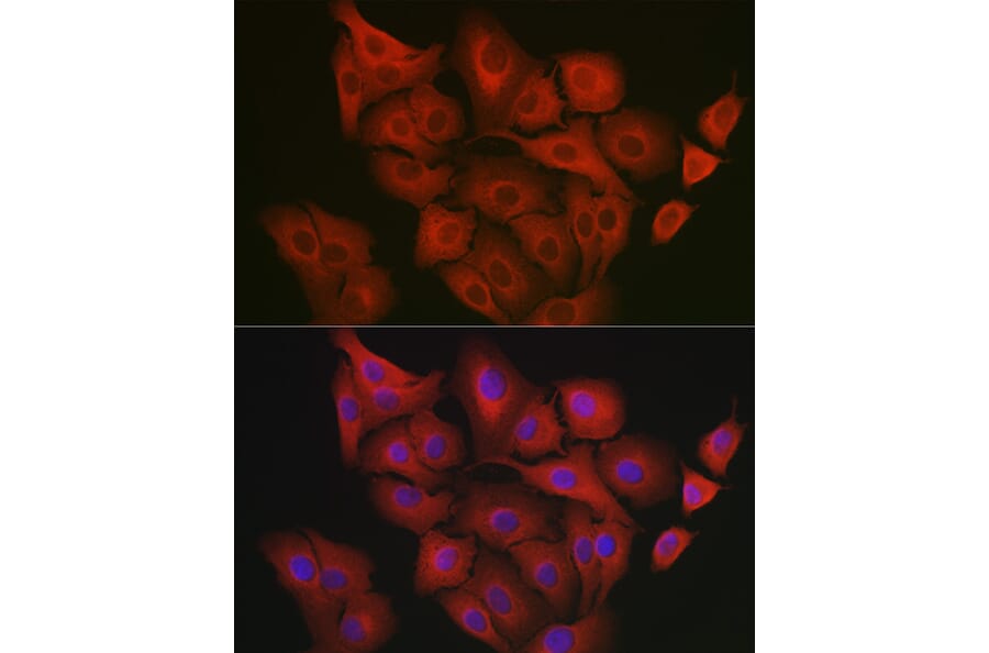 Immunofluorescence - Anti-GART Antibody (A11693) - Antibodies.com