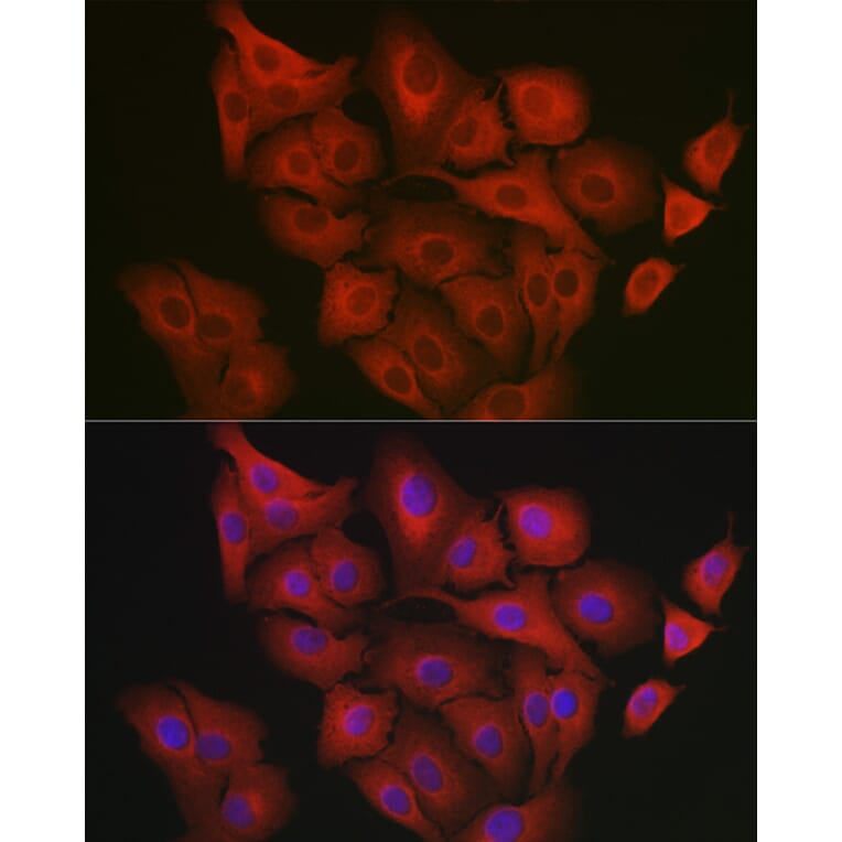 Immunofluorescence - Anti-GART Antibody (A11693) - Antibodies.com