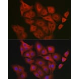 Immunofluorescence - Anti-GART Antibody (A11693) - Antibodies.com