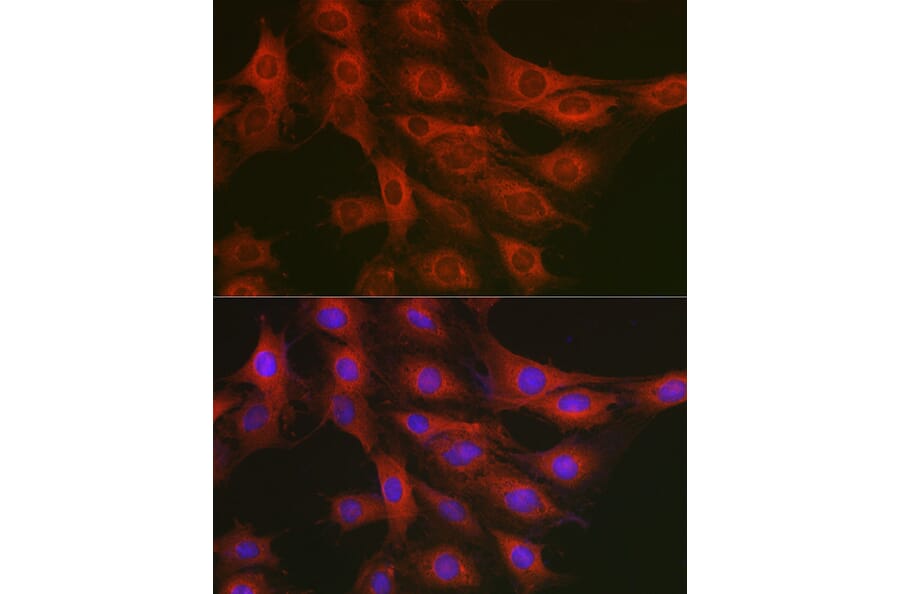 Immunofluorescence - Anti-GART Antibody (A11693) - Antibodies.com