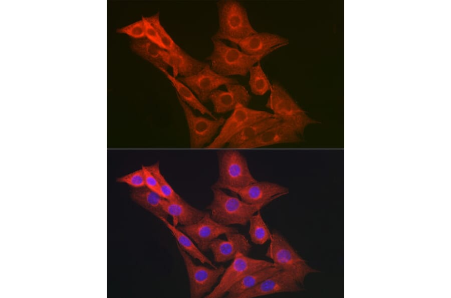 Immunofluorescence - Anti-GART Antibody (A11693) - Antibodies.com