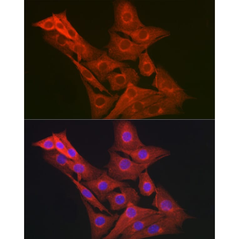 Immunofluorescence - Anti-GART Antibody (A11693) - Antibodies.com