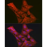 Immunofluorescence - Anti-GART Antibody (A11693) - Antibodies.com