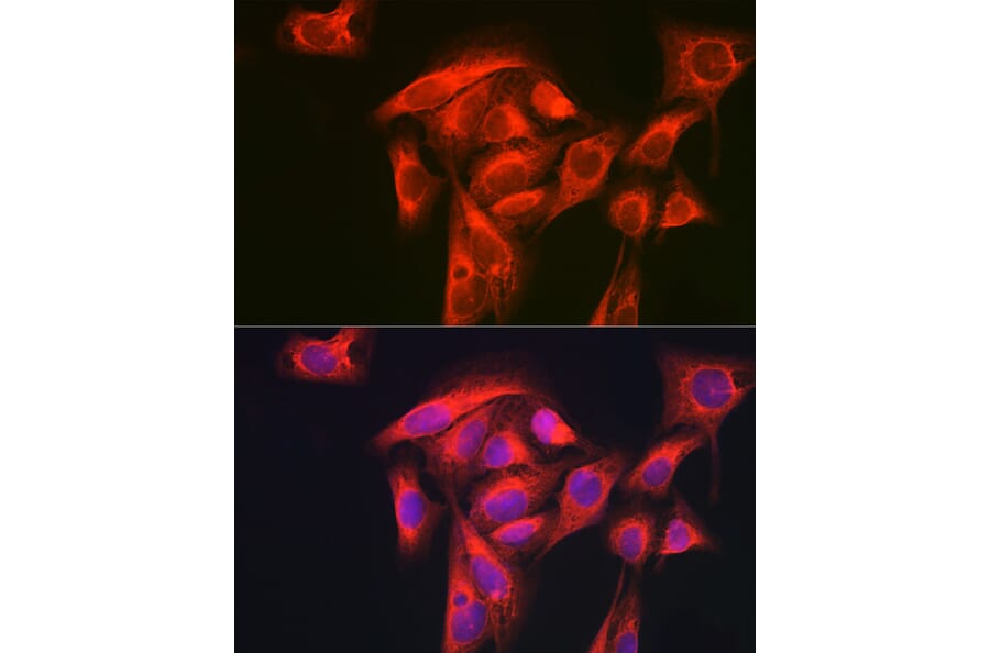 Immunofluorescence - Anti-GART Antibody (A11693) - Antibodies.com
