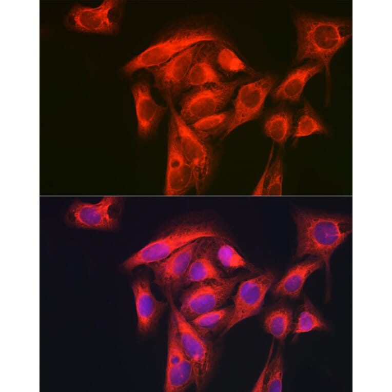 Immunofluorescence - Anti-GART Antibody (A11693) - Antibodies.com