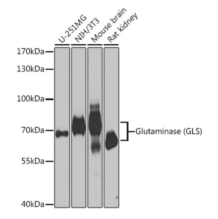 Western Blot - Anti-Glutaminase Antibody (A11694) - Antibodies.com