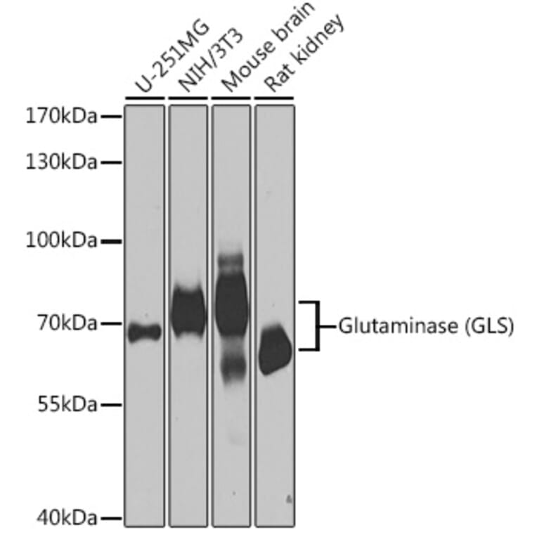 Western Blot - Anti-Glutaminase Antibody (A11694) - Antibodies.com