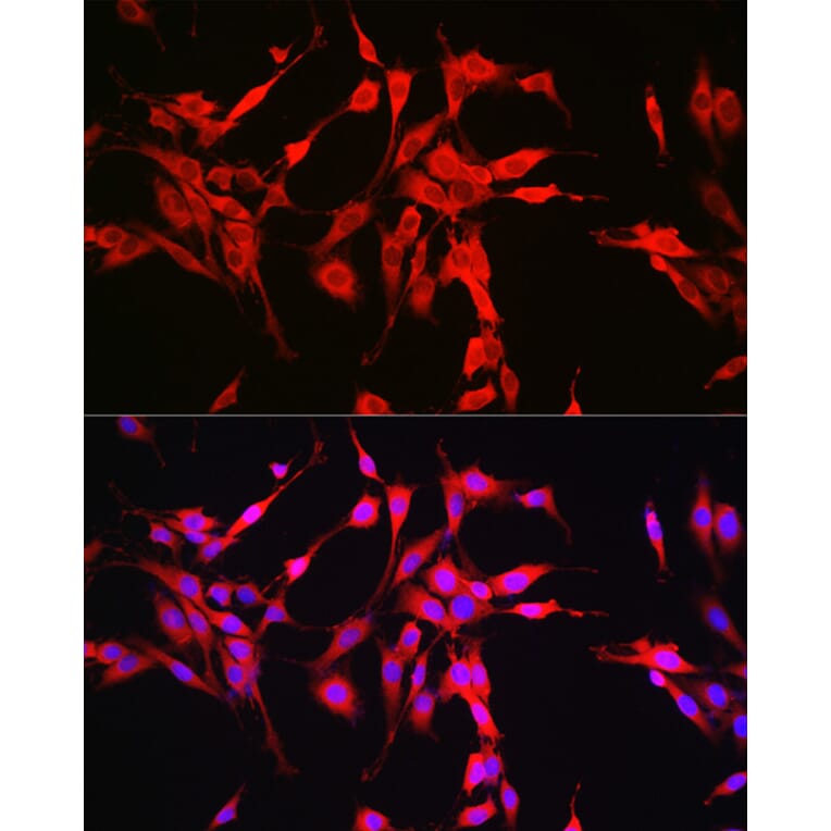Immunofluorescence - Anti-Glutaminase Antibody (A11694) - Antibodies.com