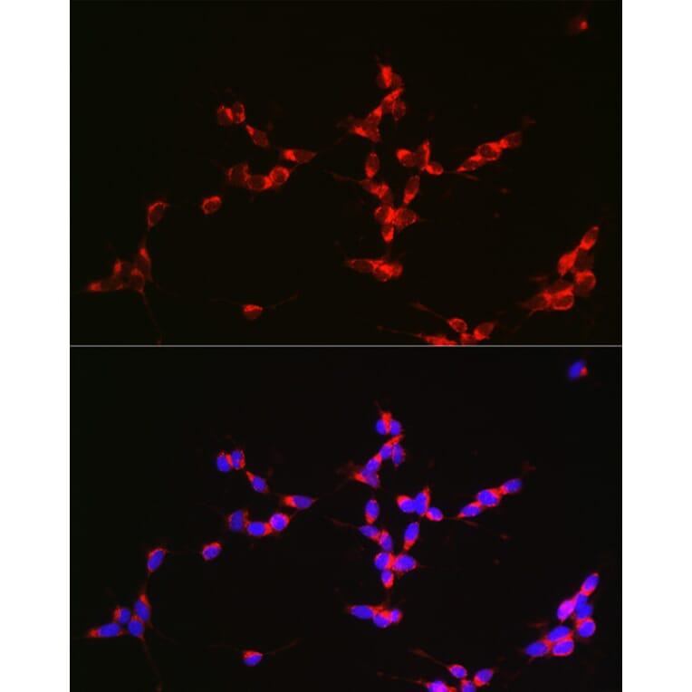 Immunofluorescence - Anti-Glutaminase Antibody (A11694) - Antibodies.com