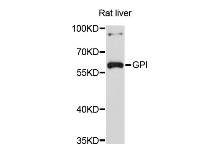Western Blot - Anti-GPI Antibody (A3896) - Antibodies.com