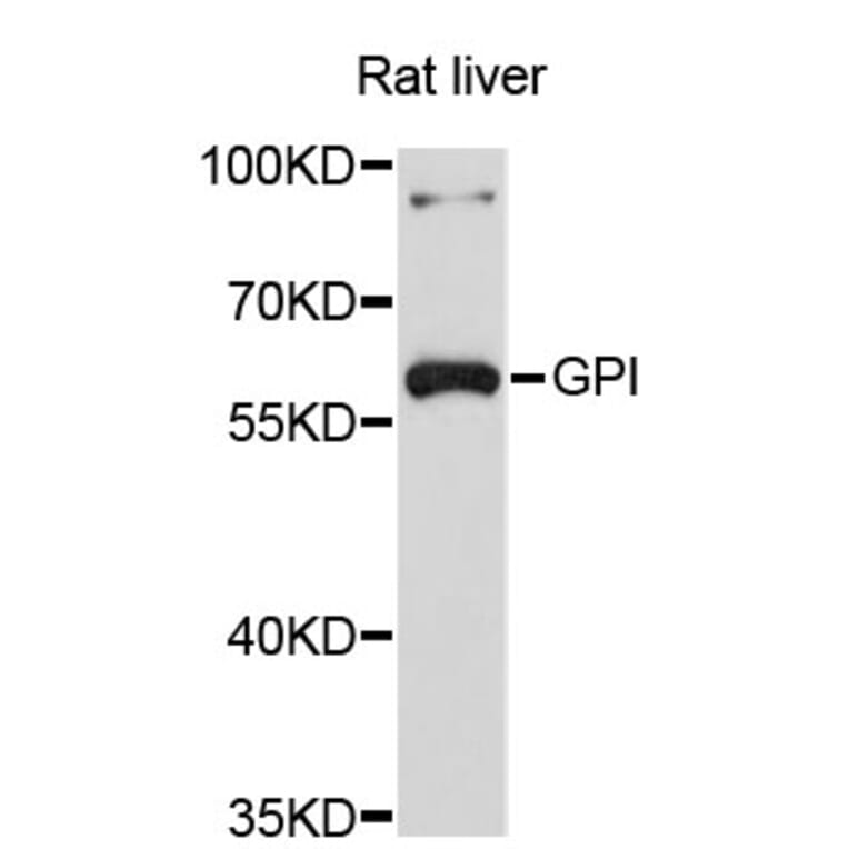 Western Blot - Anti-GPI Antibody (A3896) - Antibodies.com