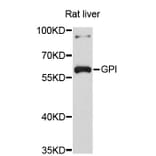Western Blot - Anti-GPI Antibody (A3896) - Antibodies.com