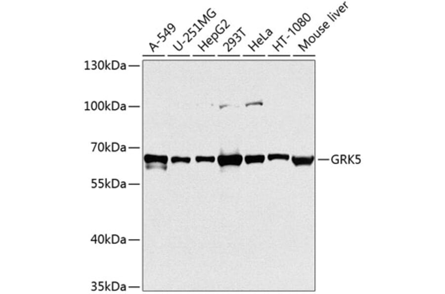 Western Blot - Anti-GRK5 Antibody (A11696) - Antibodies.com