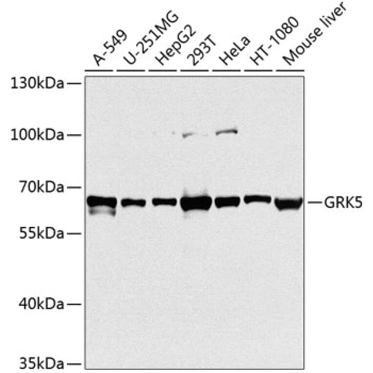 Western Blot - Anti-GRK5 Antibody (A11696) - Antibodies.com