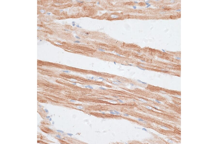 Immunohistochemistry - Anti-GRK5 Antibody (A11696) - Antibodies.com