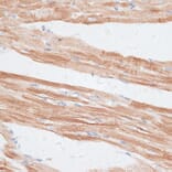 Immunohistochemistry - Anti-GRK5 Antibody (A11696) - Antibodies.com