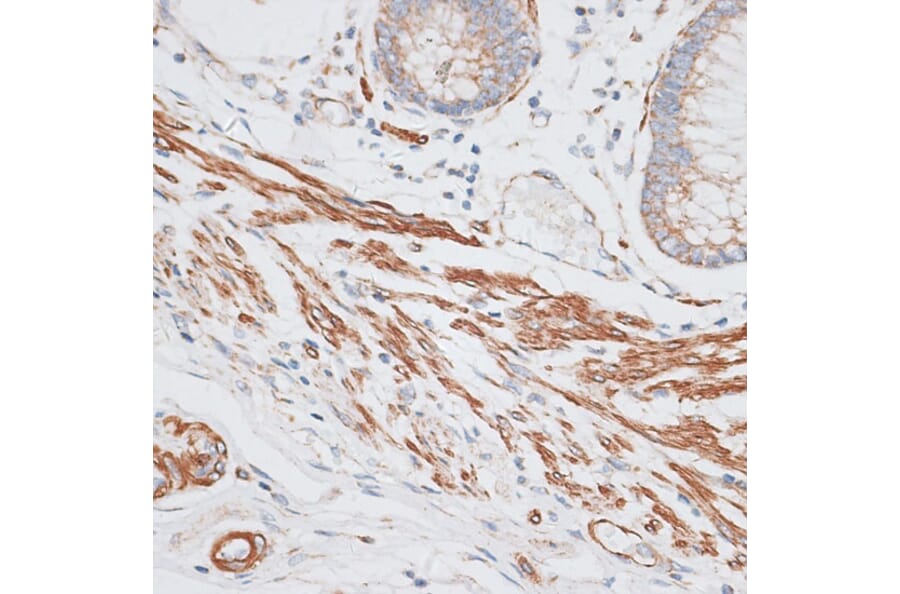 Immunohistochemistry - Anti-GRK5 Antibody (A11696) - Antibodies.com