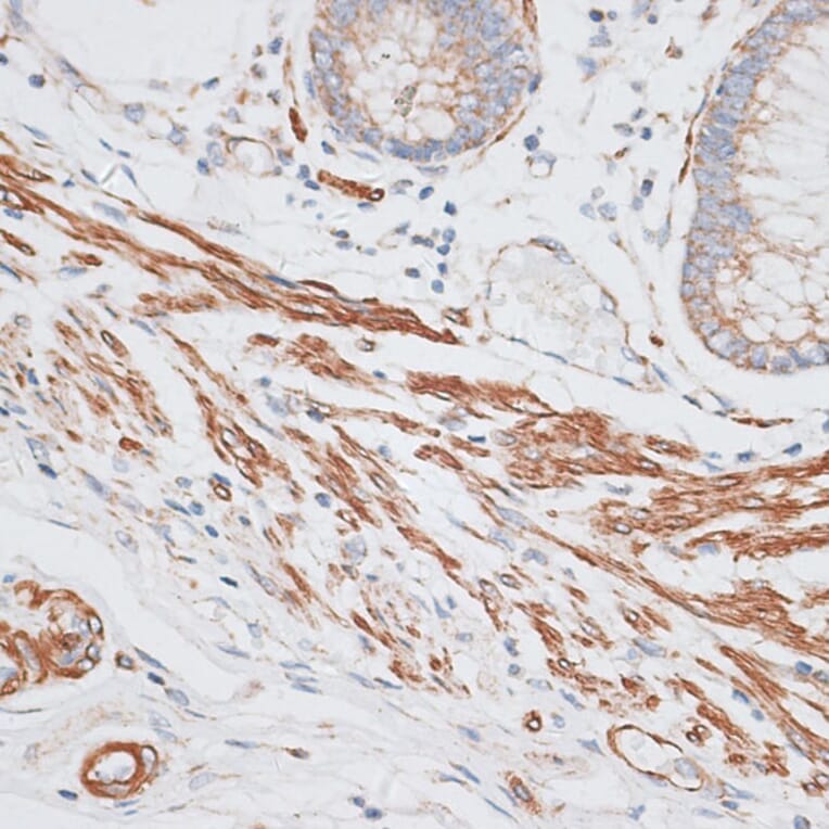 Immunohistochemistry - Anti-GRK5 Antibody (A11696) - Antibodies.com