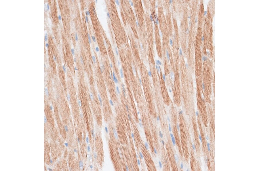 Immunohistochemistry - Anti-GRK5 Antibody (A11696) - Antibodies.com
