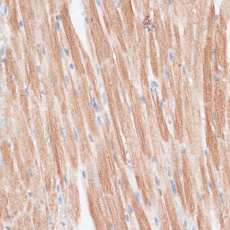 Immunohistochemistry - Anti-GRK5 Antibody (A11696) - Antibodies.com