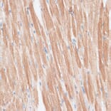 Immunohistochemistry - Anti-GRK5 Antibody (A11696) - Antibodies.com