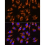 Immunofluorescence - Anti-GRK5 Antibody (A11696) - Antibodies.com