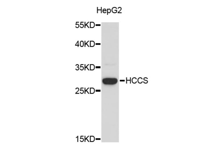 Western Blot - Anti-HCCS Antibody (A3911) - Antibodies.com