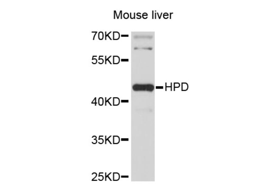 Western Blot - Anti-HPD Antibody (A3918) - Antibodies.com