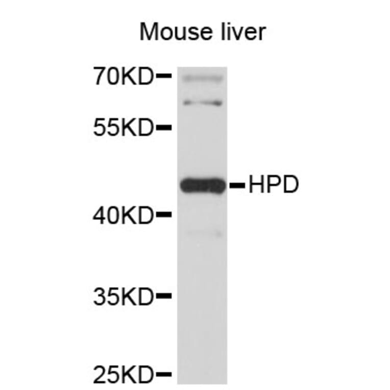 Western Blot - Anti-HPD Antibody (A3918) - Antibodies.com