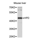 Western Blot - Anti-HPD Antibody (A3918) - Antibodies.com