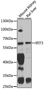 Western blot analysis of extracts of various cell lines, using Anti-IFIT3 Antibody (A3924) at 1:1,000 dilution.
Secondary antibody: Goat Anti-Rabbit IgG (H+L) (HRP) (AS014) at 1:10,000 dilution.
Lysates / proteins: 25µg per lane.
Blocking buffer: 3% non-fat dry milk in TBST.
Detection: ECL Enhanced Kit (RM00021).
Exposure time: 60s.