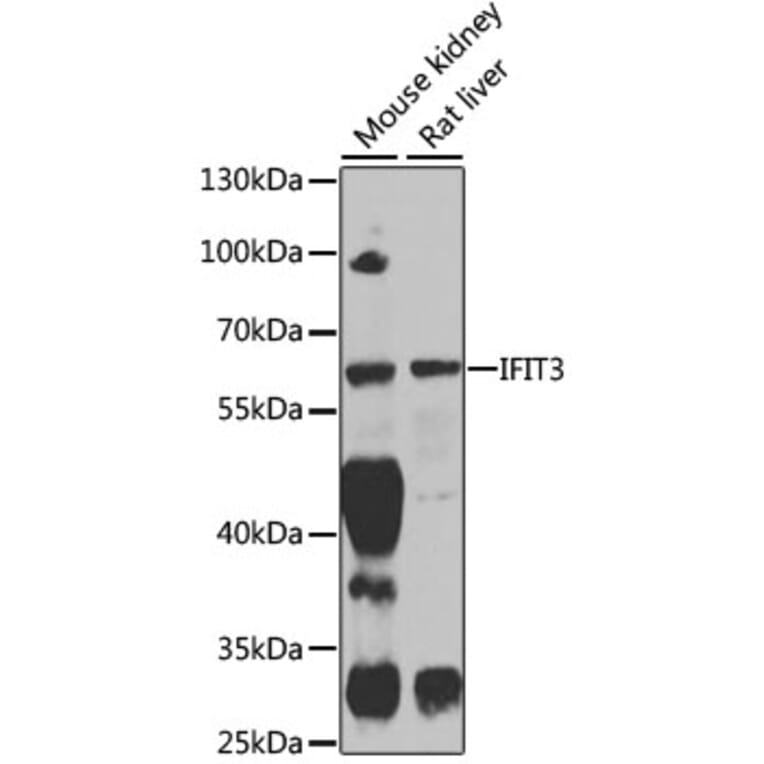 Western Blot - Anti-IFIT3/P60 Antibody (A11699) - Antibodies.com
