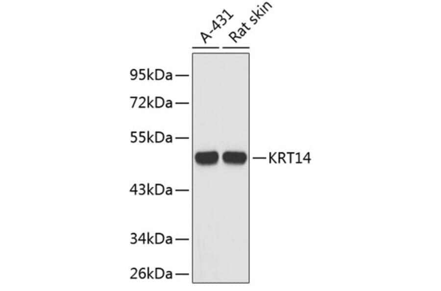Western Blot - Anti-KRT14 Antibody (A3937) - Antibodies.com