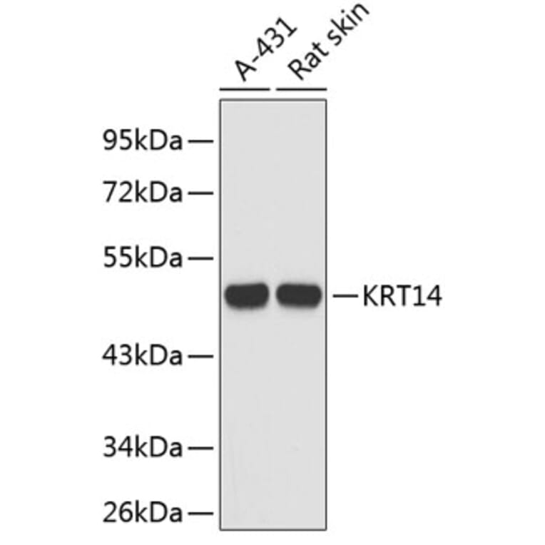 Western Blot - Anti-KRT14 Antibody (A3937) - Antibodies.com