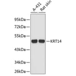 Western Blot - Anti-KRT14 Antibody (A3937) - Antibodies.com