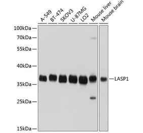 Western Blot - Anti-LASP1 Antibody (A11701) - Antibodies.com