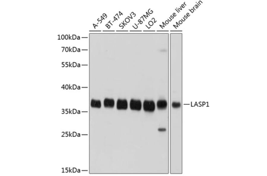 Western Blot - Anti-LASP1 Antibody (A11701) - Antibodies.com
