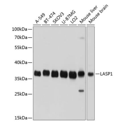 Western Blot - Anti-LASP1 Antibody (A11701) - Antibodies.com