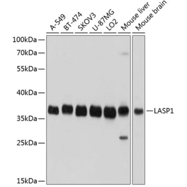 Western Blot - Anti-LASP1 Antibody (A11701) - Antibodies.com