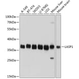 Western Blot - Anti-LASP1 Antibody (A11701) - Antibodies.com