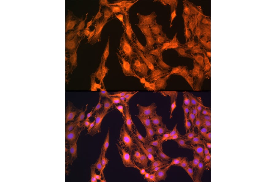 Immunofluorescence - Anti-LASP1 Antibody (A11701) - Antibodies.com