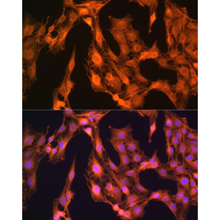 Immunofluorescence - Anti-LASP1 Antibody (A11701) - Antibodies.com